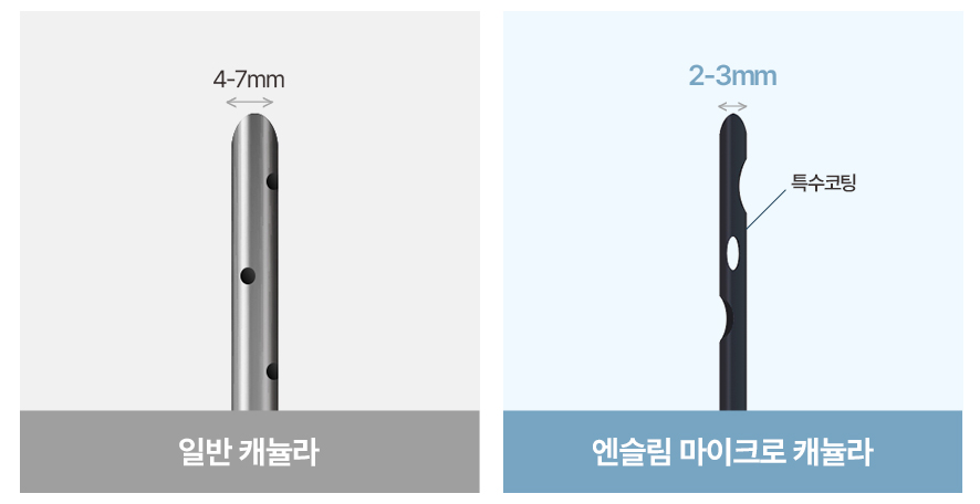 1600~2000cc 흡입 후 달라진 허벅지 라인 사진 7